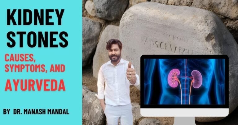 Kidney Stones: Causes, Symptoms, and Ayurveda